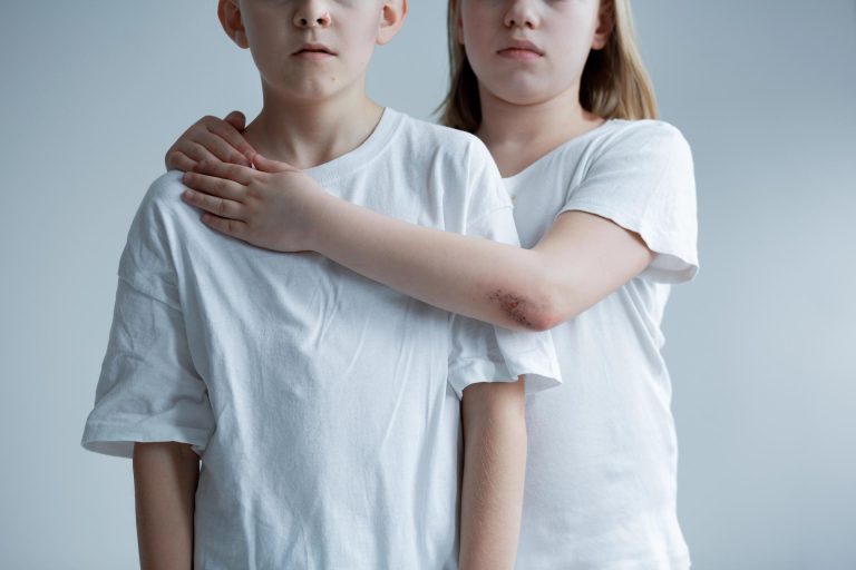 Photo illustrant les signes visibles de violence physique chez les enfants